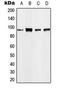 Eukaryotic Translation Elongation Factor 2 antibody, MBS8217130, MyBioSource, Western Blot image 