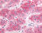 ATP Binding Cassette Subfamily B Member 1 antibody, TA341144, Origene, Immunohistochemistry frozen image 