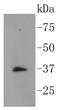 NFKB Inhibitor Alpha antibody, NBP2-67546, Novus Biologicals, Western Blot image 