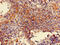 Mannosidase Alpha Class 2A Member 1 antibody, CSB-PA613697LA01HU, Cusabio, Immunohistochemistry frozen image 