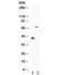 CD46 Molecule antibody, R31841, NSJ Bioreagents, Western Blot image 