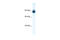 Actinin Alpha 2 antibody, 28-671, ProSci, Enzyme Linked Immunosorbent Assay image 