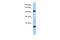 Terminal Uridylyl Transferase 1, U6 SnRNA-Specific antibody, 25-532, ProSci, Western Blot image 