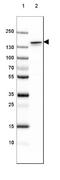 Neurofilament Medium antibody, NBP2-46618, Novus Biologicals, Western Blot image 