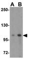 DLG Associated Protein 1 antibody, GTX85396, GeneTex, Western Blot image 