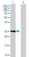 Chymotrypsinogen B1 antibody, H00001504-B02P, Novus Biologicals, Western Blot image 