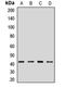 Actin Related Protein 1A antibody, LS-C667703, Lifespan Biosciences, Western Blot image 