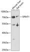Serine Peptidase Inhibitor, Kunitz Type 1 antibody, 22-201, ProSci, Western Blot image 