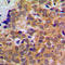 Signal Transducer And Activator Of Transcription 5A antibody, LS-C352880, Lifespan Biosciences, Immunohistochemistry frozen image 