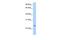 Solute Carrier Family 66 Member 2 antibody, GTX45961, GeneTex, Western Blot image 