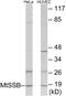 Single Stranded DNA Binding Protein 1 antibody, EKC1776, Boster Biological Technology, Western Blot image 