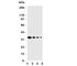 Eukaryotic Translation Initiation Factor 2 Alpha Kinase 2 antibody, R31134, NSJ Bioreagents, Western Blot image 