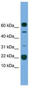 Transmembrane Protein 107 antibody, TA339611, Origene, Western Blot image 