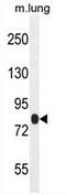 Tetratricopeptide Repeat Domain 30B antibody, AP54396PU-N, Origene, Western Blot image 