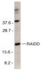 CASP2 And RIPK1 Domain Containing Adaptor With Death Domain antibody, LS-C256, Lifespan Biosciences, Western Blot image 