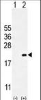 Cyclin Dependent Kinase Inhibitor 2C antibody, LS-C168628, Lifespan Biosciences, Western Blot image 