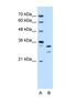 Acidic Nuclear Phosphoprotein 32 Family Member E antibody, NBP1-56294, Novus Biologicals, Western Blot image 