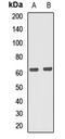 Protein Phosphatase 2 Regulatory Subunit B'Gamma antibody, LS-C668181, Lifespan Biosciences, Western Blot image 