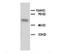 Alkaline Phosphatase, Biomineralization Associated antibody, PA1004, Boster Biological Technology, Western Blot image 