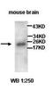 TNF Receptor Superfamily Member 10a antibody, orb76956, Biorbyt, Western Blot image 