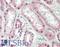 COP9 Signalosome Subunit 2 antibody, LS-B12197, Lifespan Biosciences, Immunohistochemistry paraffin image 