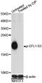 Cofilin 1 antibody, STJ22068, St John