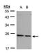 Ribosomal Protein L17 antibody, PA5-27544, Invitrogen Antibodies, Western Blot image 