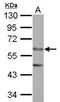 Endoplasmic Reticulum Oxidoreductase 1 Alpha antibody, GTX112589, GeneTex, Western Blot image 