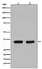 Cell Division Cycle 34 antibody, M03038, Boster Biological Technology, Western Blot image 