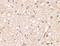 Glutamate Ionotropic Receptor Kainate Type Subunit 1 antibody, NBP1-76850, Novus Biologicals, Immunohistochemistry paraffin image 