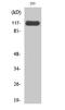 Janus Kinase 2 antibody, STJ93794, St John