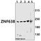 Zinc Finger Protein 638 antibody, A08655-1, Boster Biological Technology, Western Blot image 