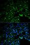 UDP-Glucose 6-Dehydrogenase antibody, LS-C331353, Lifespan Biosciences, Immunofluorescence image 