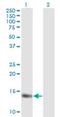 Myoglobin antibody, H00004151-M13, Novus Biologicals, Western Blot image 