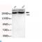 Chromodomain Helicase DNA Binding Protein 3 antibody, LS-C812914, Lifespan Biosciences, Western Blot image 