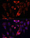 Acyl-CoA Synthetase Short Chain Family Member 2 antibody, 22-251, ProSci, Immunofluorescence image 