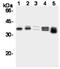 Cyclin D1 antibody, M00149-2, Boster Biological Technology, Western Blot image 
