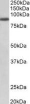 Fibroblast Growth Factor Receptor 1 antibody, MBS422865, MyBioSource, Western Blot image 