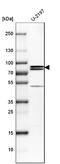 Patatin Like Phospholipase Domain Containing 8 antibody, NBP1-83098, Novus Biologicals, Western Blot image 
