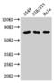 MX Dynamin Like GTPase 1 antibody, CSB-PA015249LA01HU, Cusabio, Western Blot image 
