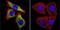 ATPase Sarcoplasmic/Endoplasmic Reticulum Ca2+ Transporting 2 antibody, MA3-910, Invitrogen Antibodies, Immunofluorescence image 