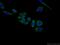 WW Domain Containing E3 Ubiquitin Protein Ligase 1 antibody, 13587-1-AP, Proteintech Group, Immunofluorescence image 