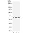 Insulin Like Growth Factor Binding Protein 2 antibody, R31993, NSJ Bioreagents, Western Blot image 
