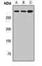 Envoplakin antibody, LS-C668252, Lifespan Biosciences, Western Blot image 