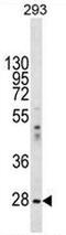 Eukaryotic Translation Initiation Factor 2B Subunit Alpha antibody, AP51391PU-N, Origene, Western Blot image 
