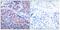 NFKB Inhibitor Alpha antibody, A01139-1, Boster Biological Technology, Immunohistochemistry paraffin image 