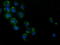 Hydroxyacid Oxidase 1 antibody, M09159-2, Boster Biological Technology, Immunofluorescence image 