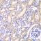 Adenylate Kinase 4 antibody, GTX30038, GeneTex, Immunohistochemistry paraffin image 