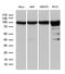 Karyopherin Subunit Beta 1 antibody, LS-C796063, Lifespan Biosciences, Western Blot image 