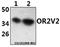 Olfactory Receptor Family 2 Subfamily V Member 2 antibody, A17542, Boster Biological Technology, Western Blot image 